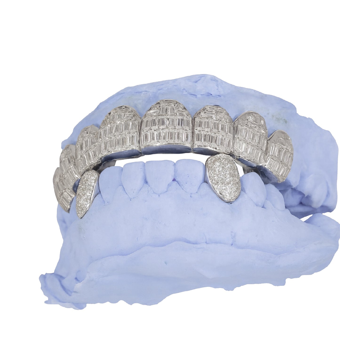 VVS Diamond Grillz
