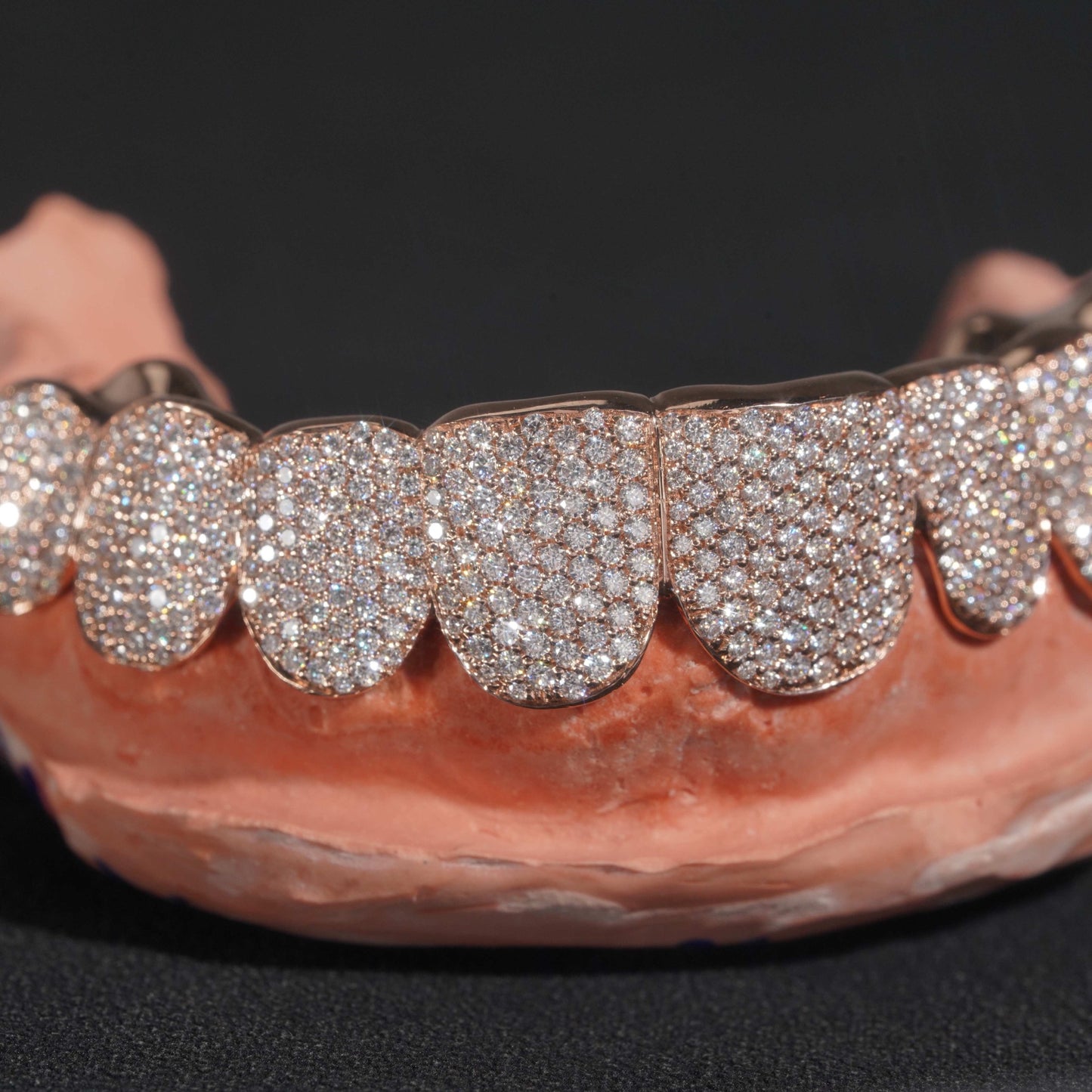 Rose Gold VVS Diamond Grillz